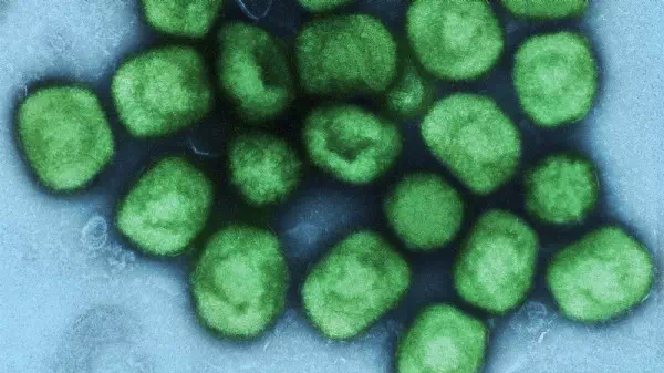 „Affenpocken“ - WHO ruft wegen Mpox weltweite Notlage aus