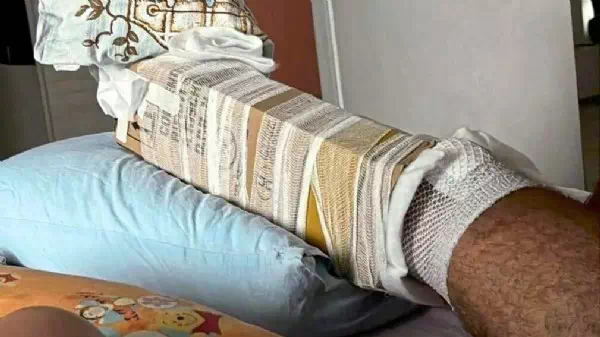 Kein Material! - Tragikomik: Karton statt Gips nach Wadenbeinbruch