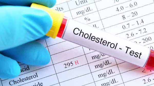 Erhöhte Werte  - Wie gefährlich ist Cholesterin wirklich?