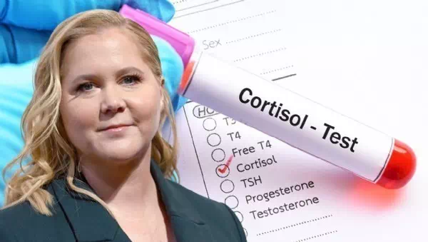 Aufgedunsenes Gesicht - Amy Schumer: Das steckt hinter dem Cushing-Syndrom