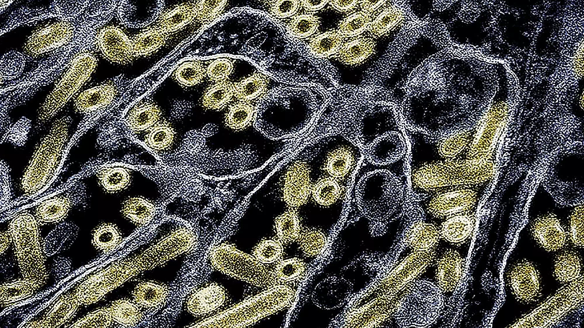 Erster H5N1-Todesfall in den USA bestätigt