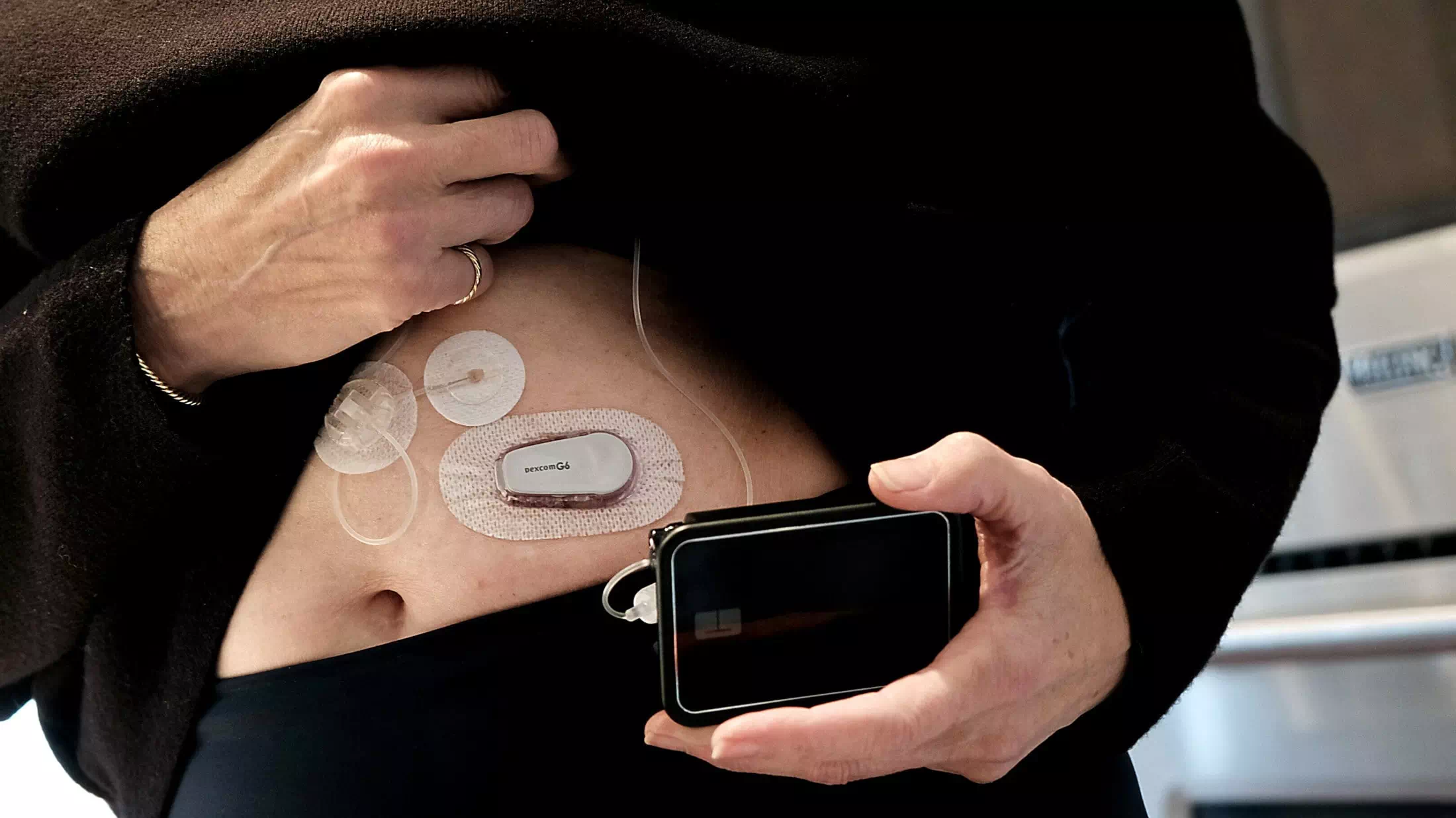 Durchbruch: Transplantation von Insulin-Zellen gelingt!